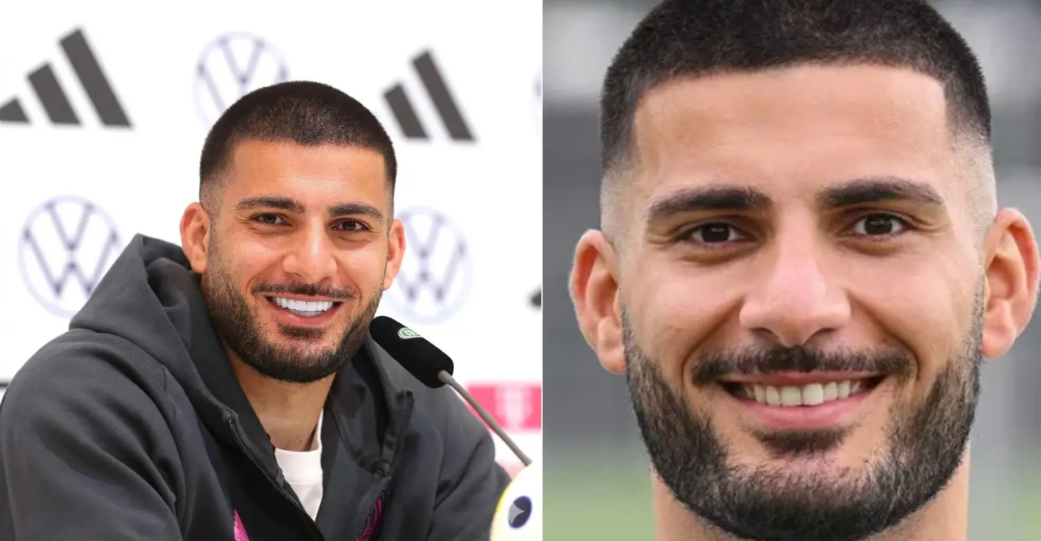 Deniz Undav teeth